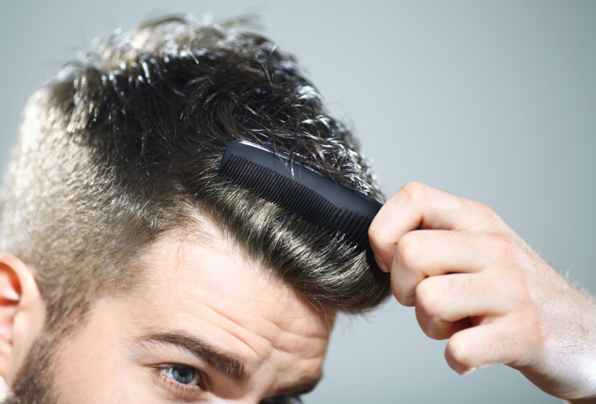 Top Five Tips To Prevent Baldness